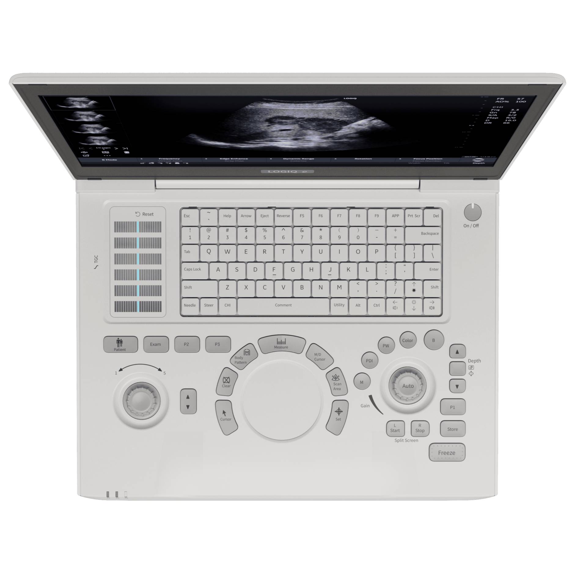 LOGIQ e R9™