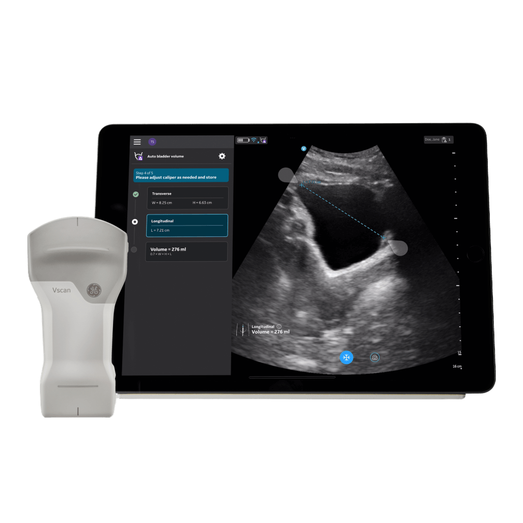 Vscan Air™ CL Vscan Air™ CL