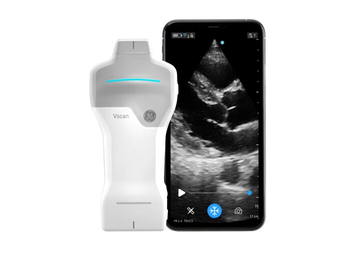 Vscan Air™ SL