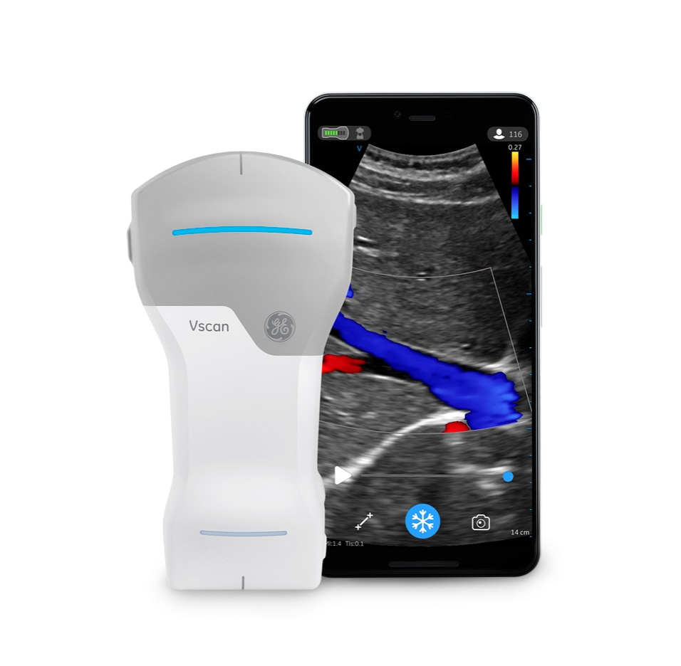 Vscan Air™ CL (R2) Old
