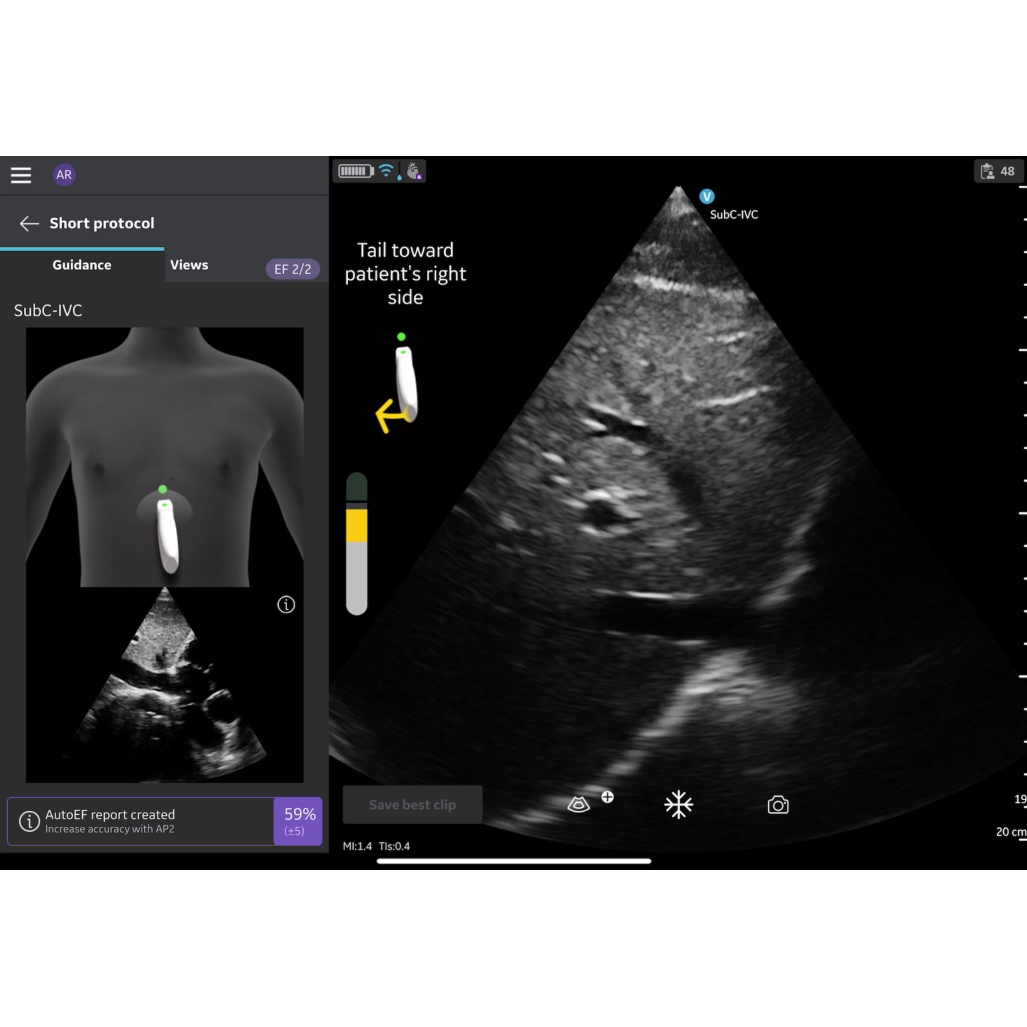 Vscan Air SL Caption AI (Stand-alone) FlexiPackage EUR Vscan Air SL Caption AI (Stand-alone) FlexiPackage EUR