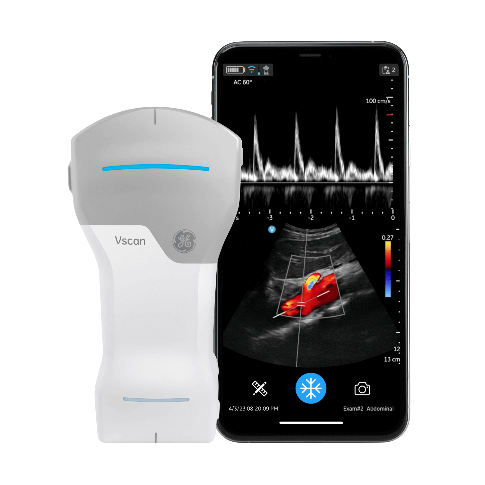 Vscan Air™ CL Vscan Air™ CL