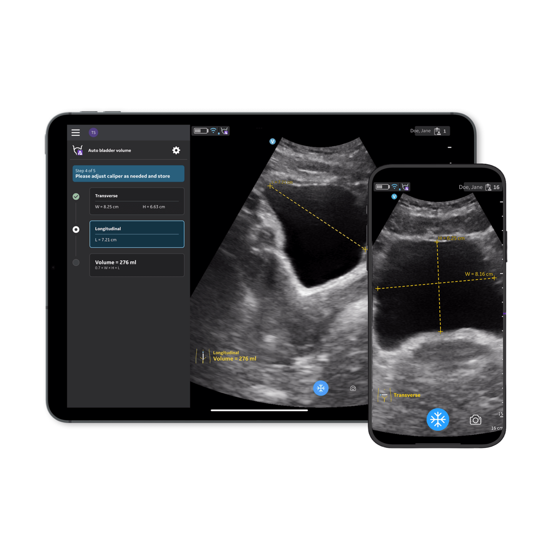 Vscan Air™ CL Innovations