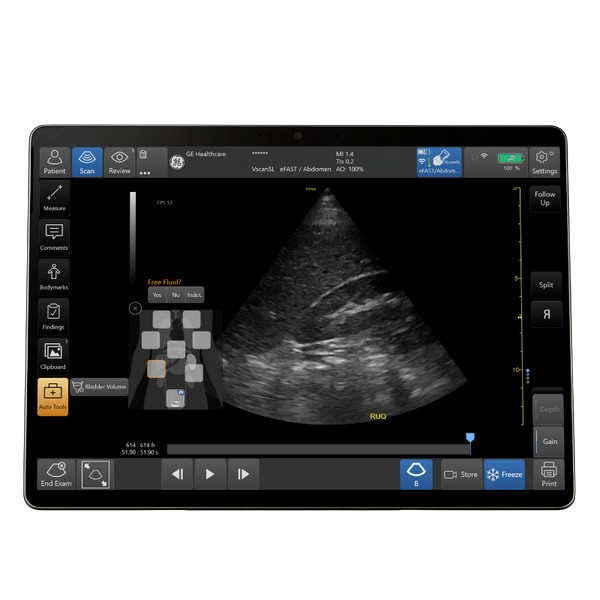 Venue Sprint Tablet